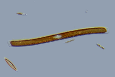 Diatomée - algue unicellulaire  (Nitzschia sigmoidea) x100